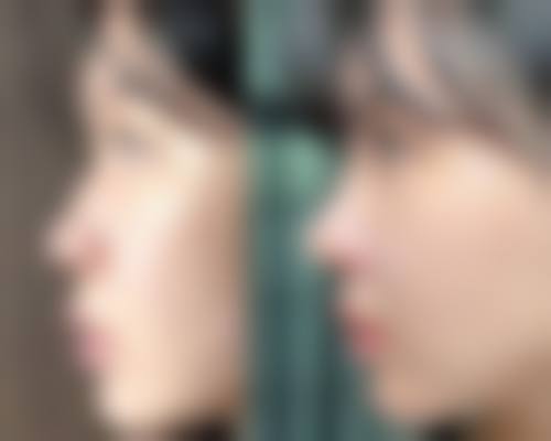 【北京维凯尔医疗美容医院真实患者评价】