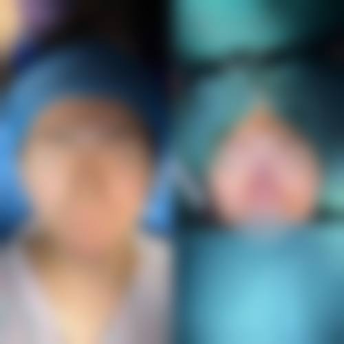 【六盘水星殿医疗美容医院擅长项目有哪些?】
