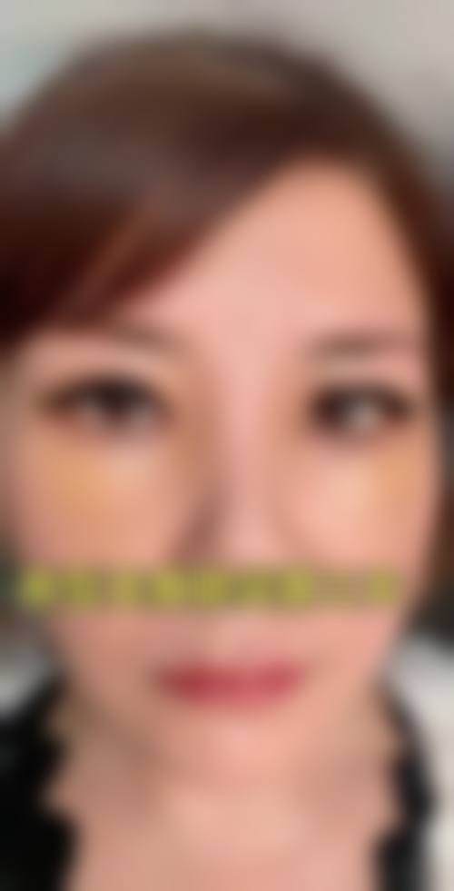 【临沂伊尔美纯韩整形美容医院擅长项目有哪些？】