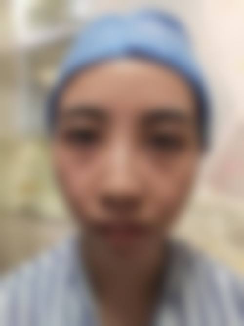 【临沂伊尔美纯韩整形美容医院交通路线及预约方式】