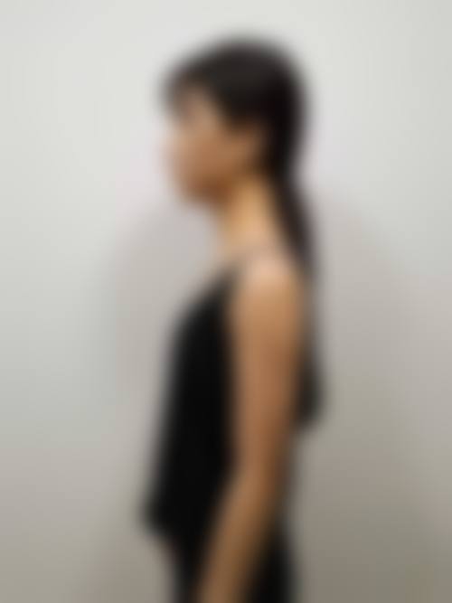 【长春宫丽娟医疗美容诊所真实患者评价】