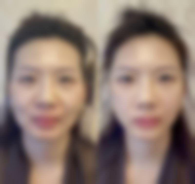 张颖患者评价