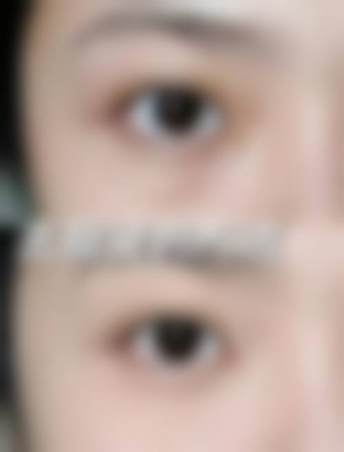 【长春张艳茹整形医疗美容诊所真实患者评价】