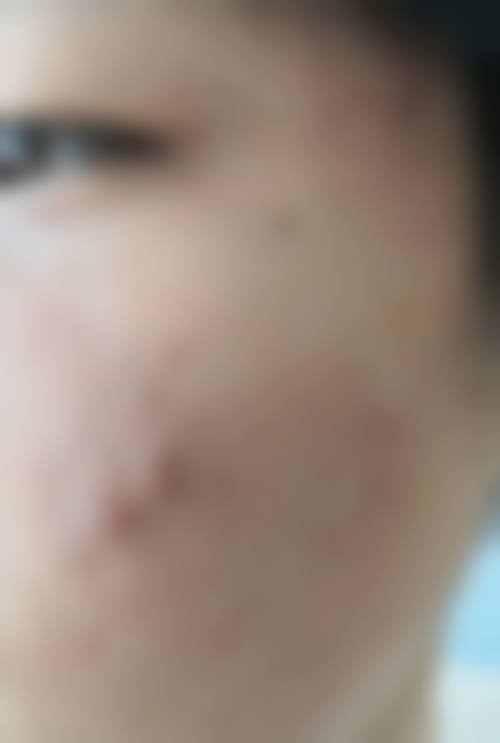 【天津南开区痘博士医疗美容门诊部交通路线及预约方式】