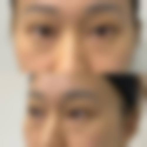 【杭州解放军第117医院美容整形外科中 心真实患者评价】