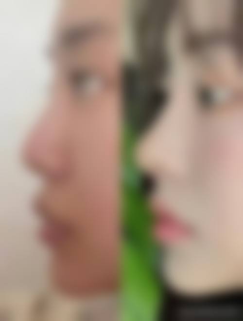 【2026达州紫蝴蝶整形美容诊所项目价格参考】