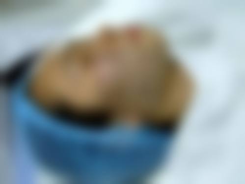 【达州紫蝴蝶整形美容诊所真实患者评价】