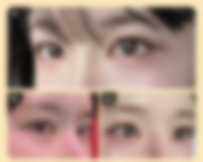 【韩国i-Line整形外科擅长项目有哪些？】