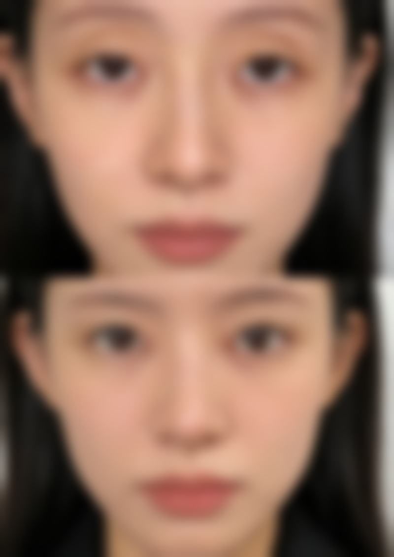 【六、葫芦岛市龙港区华美医疗美容门诊部真实患者口碑评价】