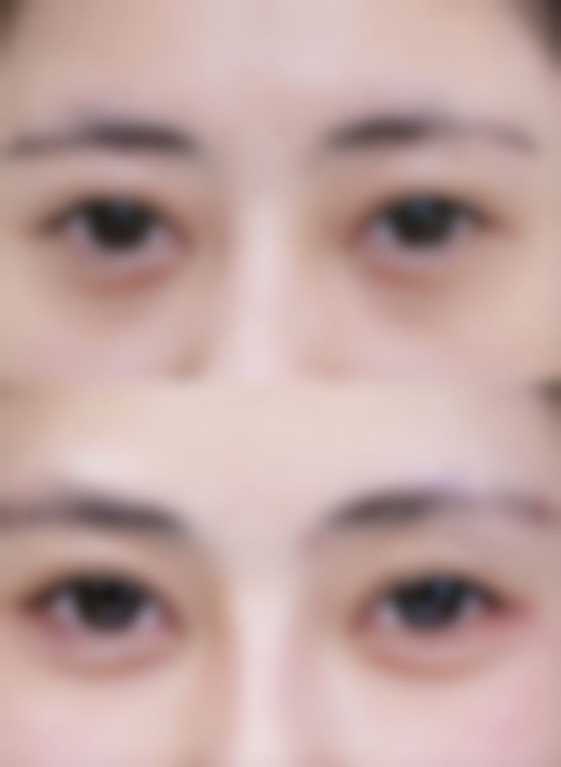 【六、江南路美毛植发中 心真实患者口碑评价】