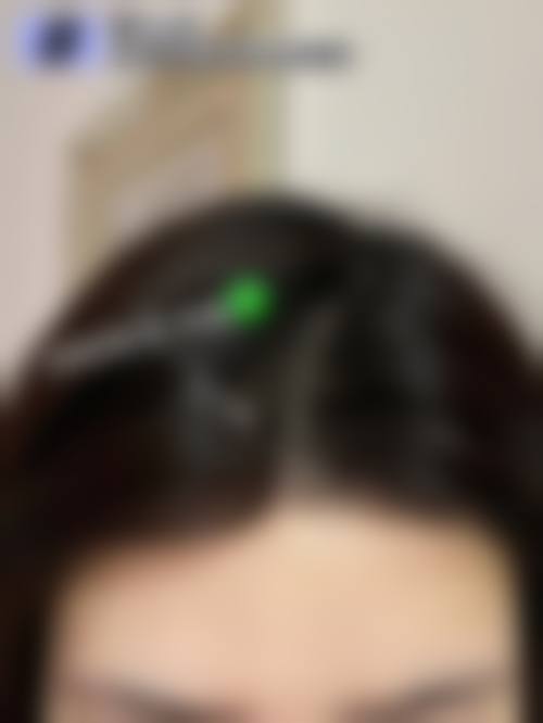【三、石家庄碧莲盛植发医院骨干医生团队与技术标准】