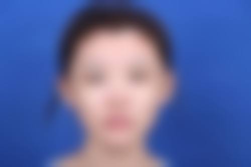 【六、深圳皇佳亿美医疗美容真实患者口碑评价】
