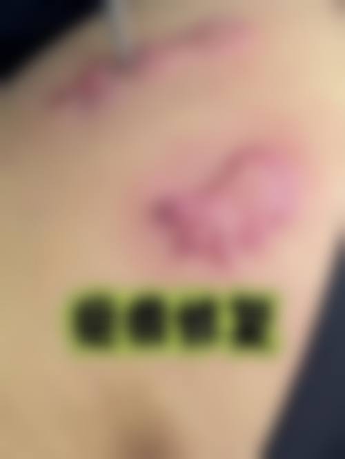 【二、石家庄碧莲盛植发医院擅长诊疗项目有哪些】