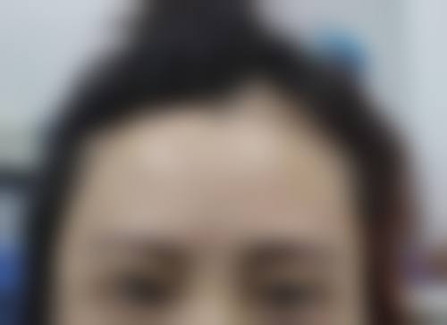 【二、哈尔滨大麦植发医院（原科发源）擅长诊疗项目有哪些】