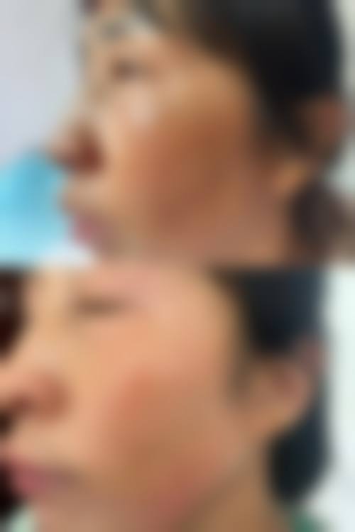 【二、泉州丰泽东大医疗美容医院擅长诊疗项目有哪些】