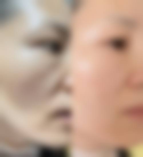 【四、2026 深圳广美医疗美容门诊部项目收费价格参考】