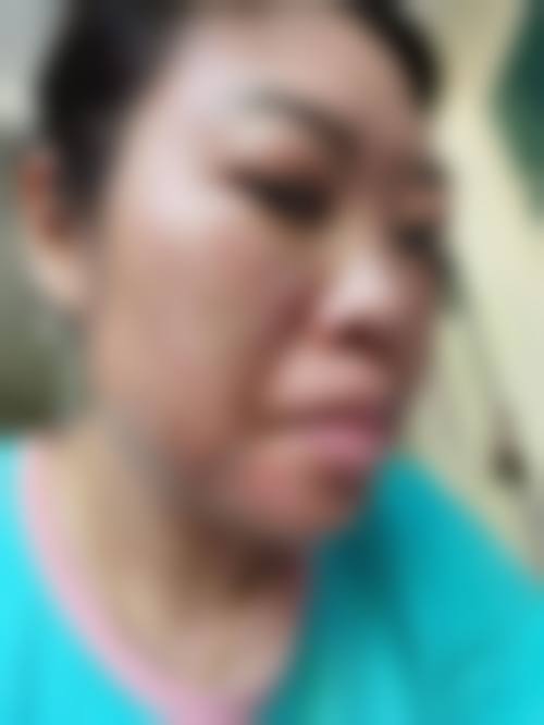 六安伊而美整形美容地址及到院路线