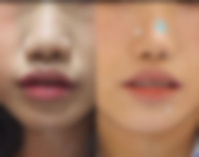 侯静擅长项目列表
