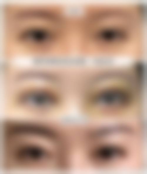 【四、2026 广安愈美整形医院项目收费价格参考】
