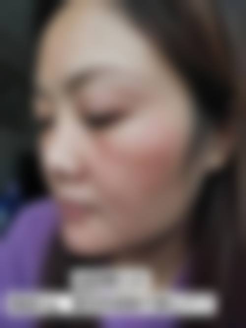 【二、昆明花月容整形医院擅长诊疗项目有哪些】