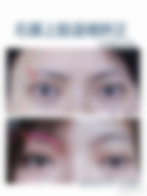 【六、长春张曼整形美容诊所真实患者口碑评价】