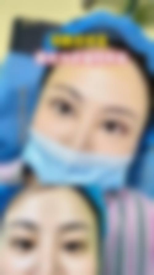 【四、2026 武汉可素美整形医院项目收费价格参考】