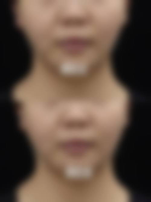 【五、普洱云美医院医疗美容整形科交通路线指南与预约挂号流程】
