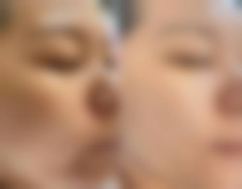 【二、普洱云美医院医疗美容整形科擅长诊疗项目有哪些】