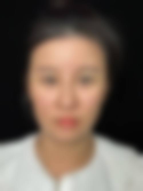 【六、河源华美整形门诊部真实患者口碑评价】