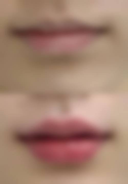 【二、本溪赵玉莲美容外科诊所擅长诊疗项目有哪些】