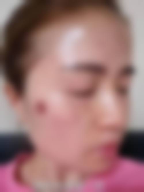 【六、三亚福音国内外整形美容医院真实患者口碑评价】