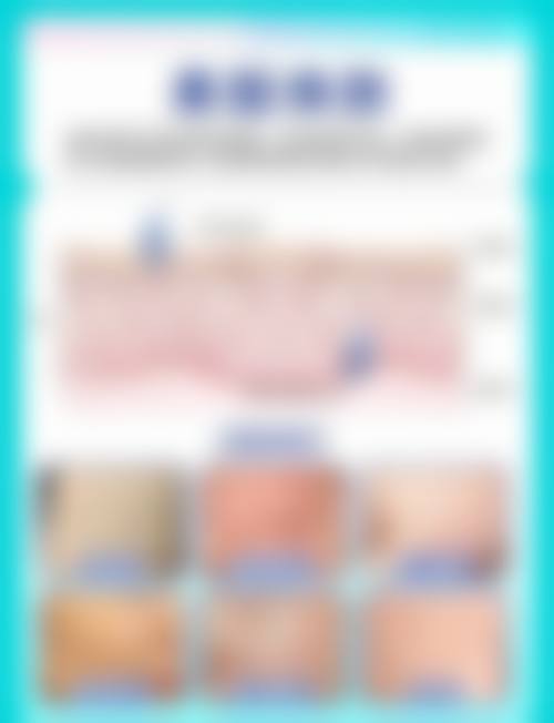 【六、本溪赵玉莲美容外科诊所真实患者口碑评价】