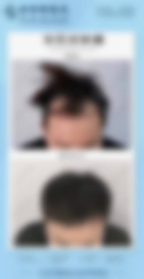 【三、2026北京冰蝶整形美容医院项目收费价格参考】