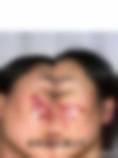 【六、威海星芙妍华发新天地医疗美容诊所真实患者口碑评价】