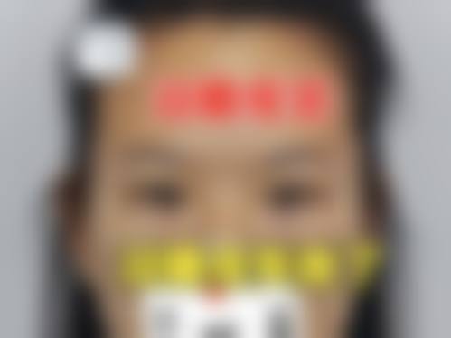 【四、2026 沈阳沈河兰玉整形医院项目收费价格参考】