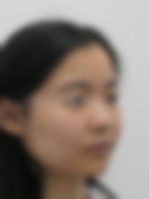 【二、韩国灵气整形医院擅长诊疗项目有哪些】