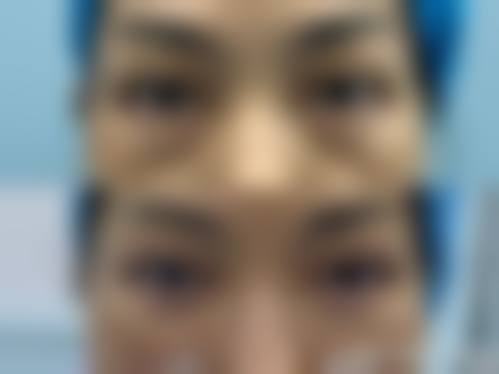 【四、2026 深圳春天海岸医疗美容门诊部项目收费价格参考】