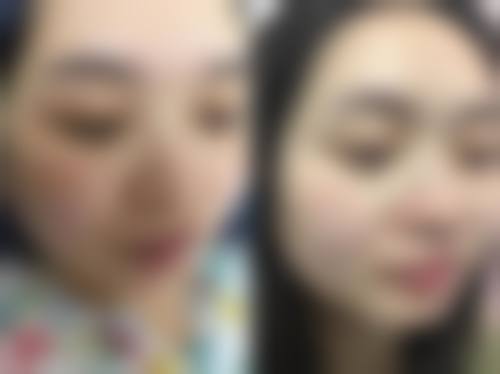 【五、韩国安成丰AHN整形医院交通路线指南与预约挂号流程】