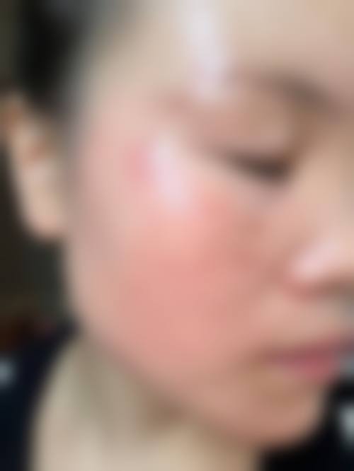 【六、BN整形外科真实患者口碑评价】