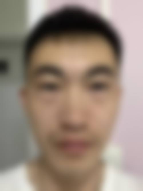 【六、宝鸡优碧妍医学美容诊所真实患者口碑评价】
