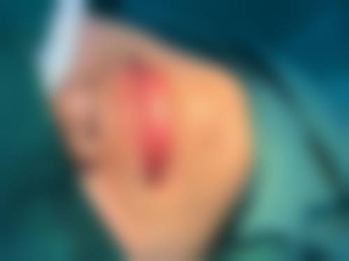 【二、宁波雅太医疗美容诊所擅长诊疗项目有哪些】