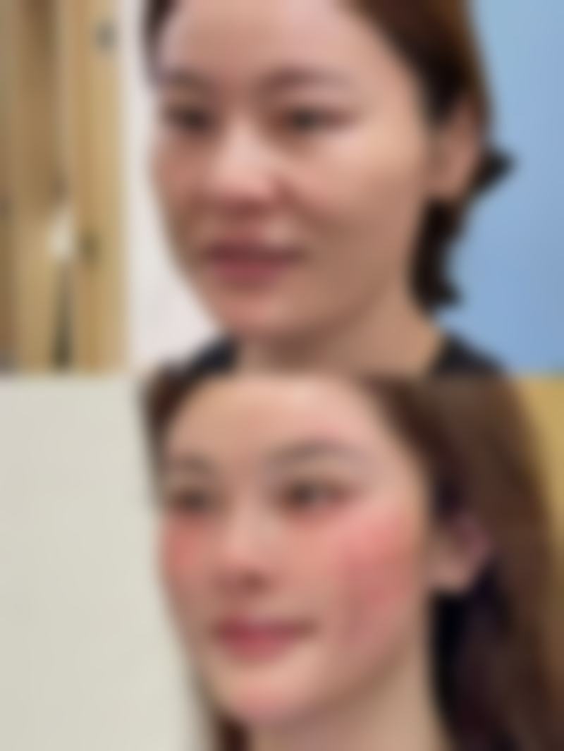 【二、诸城医学美容中 心擅长诊疗项目有哪些】