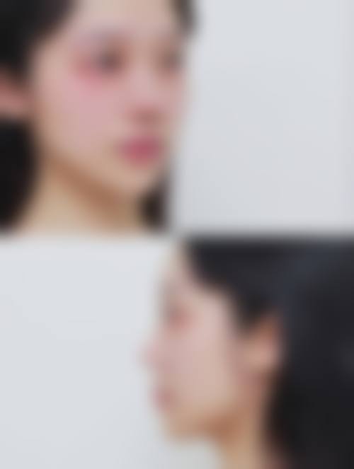 【二、天津碧莲盛不剃发植发医院擅长诊疗项目有哪些】
