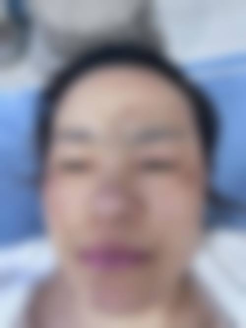 【二、浏阳伊百丽医疗美容诊所擅长诊疗项目有哪些】