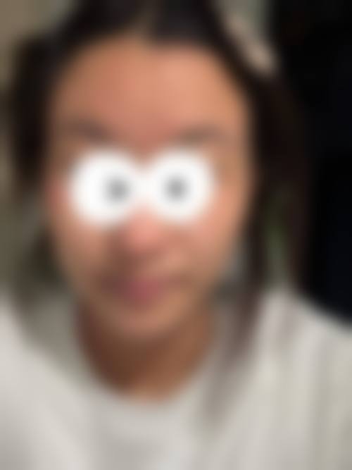【二、常州兰陵医院整形美容中 心擅长诊疗项目有哪些】