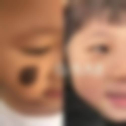 【二、解放军81医院烧伤整形外科擅长诊疗项目有哪些】