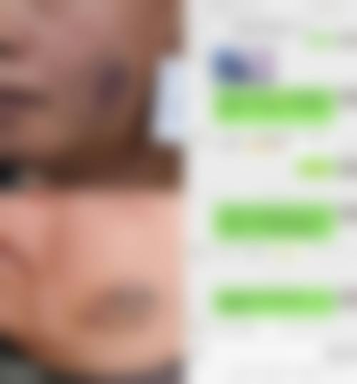 【五、解放军81医院烧伤整形外科交通路线指南与预约挂号流程】