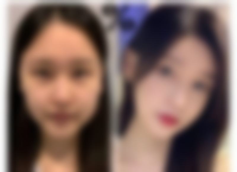 彭国凯擅长项目列表