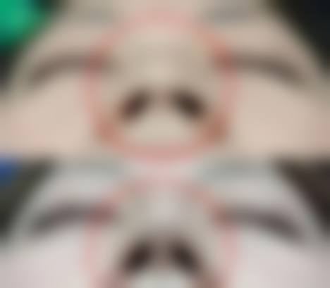 【五、徐州秀研整形医院真实患者口碑评价】