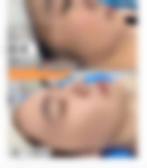 【二、安岳艺美李祖培医疗美容门诊部擅长诊疗项目有哪些】